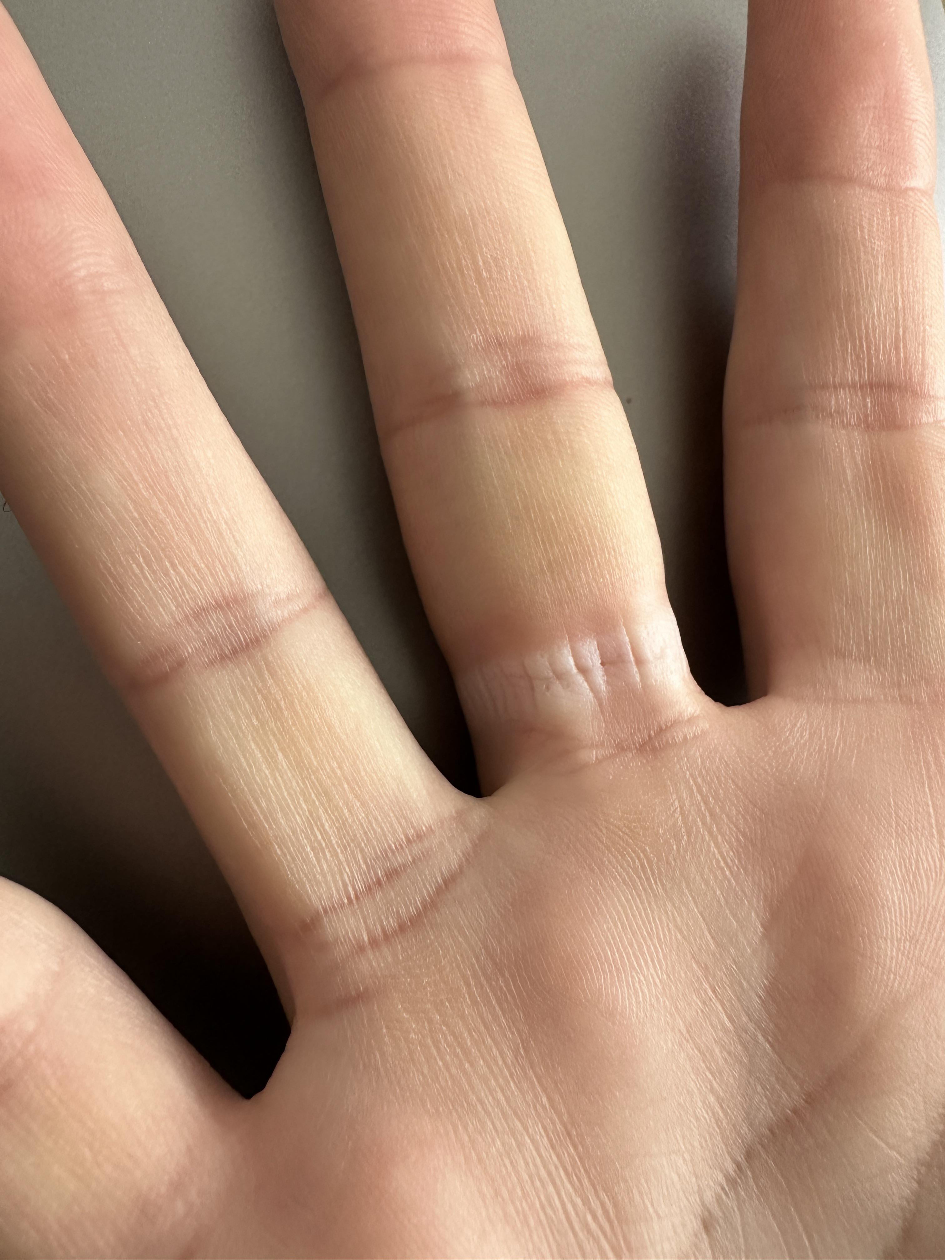 can ultrahuman ring get wet